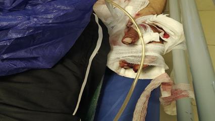 حمله خرس به چوپان در هوراند